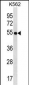 LAX1 Antibody (C-term)